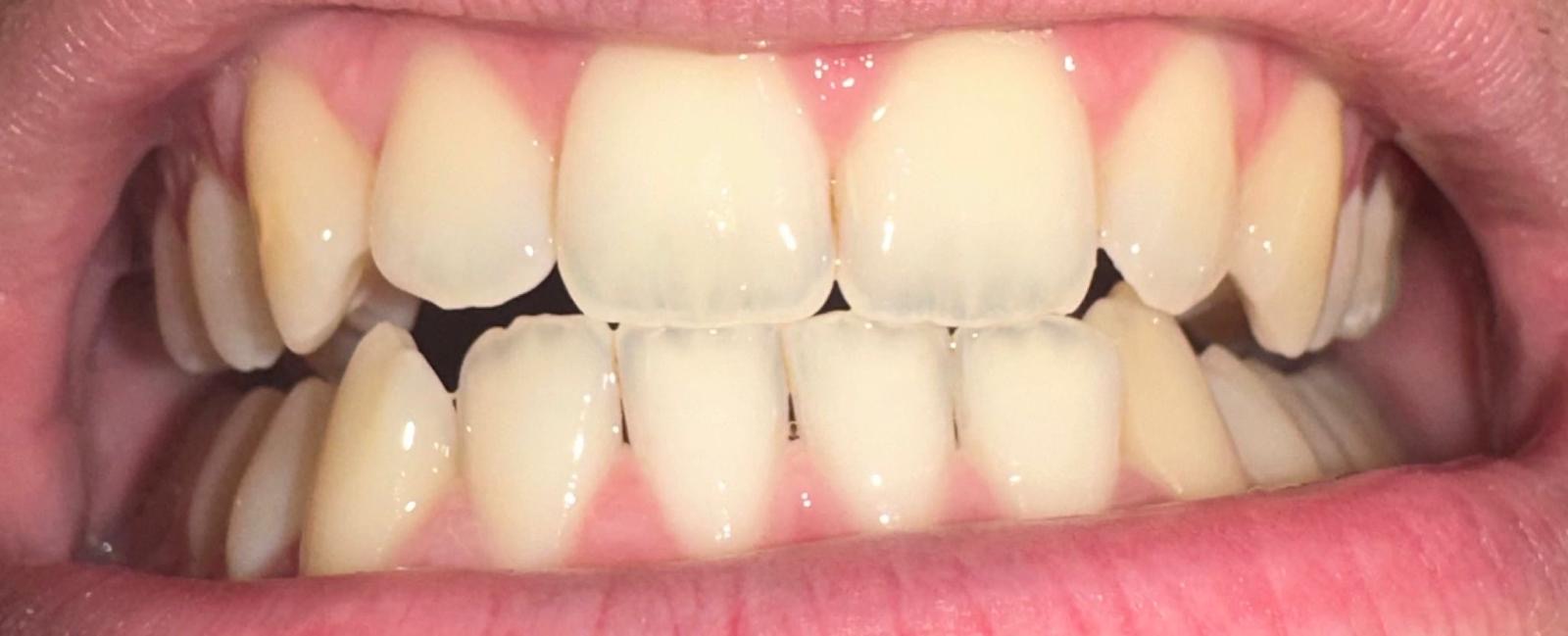 eb603512 fbcc 49b1 af60 0dcc61cdf6f3